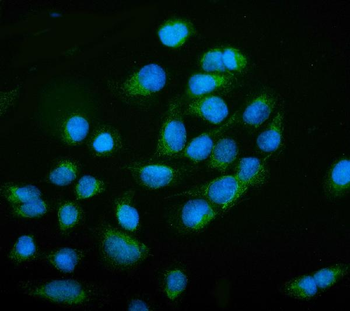 Anti-NCAM1 Antibody