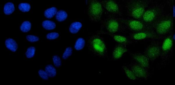 PHF21B Rabbit Polyclonal Antibody