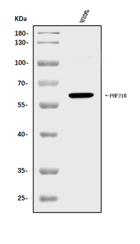 Anti-PHF21B Antibody