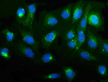 Anti-cGKI/PRKG1 Antibody