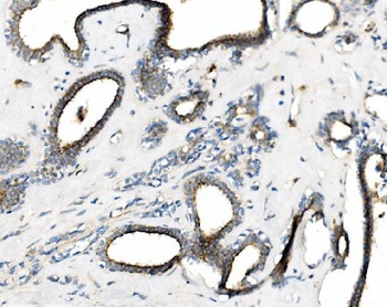 cGKI/PRKG1 Antibody