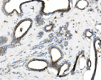 Anti-cGKI/PRKG1 Antibody
