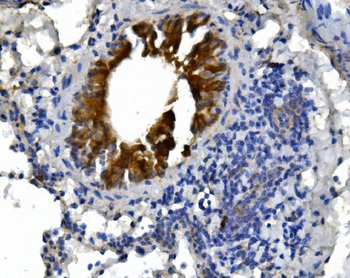 Anti-cGKI/PRKG1 Antibody