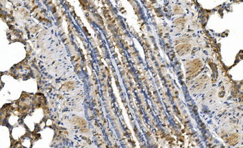 Anti-cGKI/PRKG1 Antibody