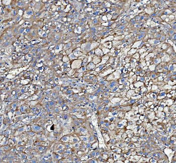 Anti-Poliovirus Receptor/PVR Antibody