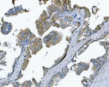 Anti-Poliovirus Receptor/PVR Antibody