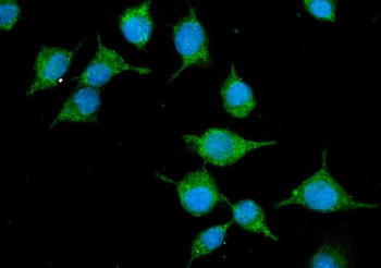 Anti-SLC10A1/NTCP1 Antibody