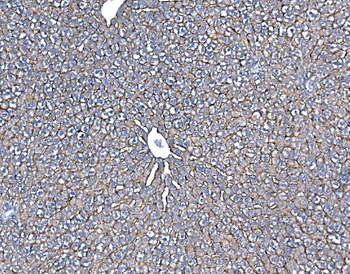 Anti-SLC10A1/NTCP1 Antibody