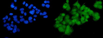 Anti-SOX18 Antibody
