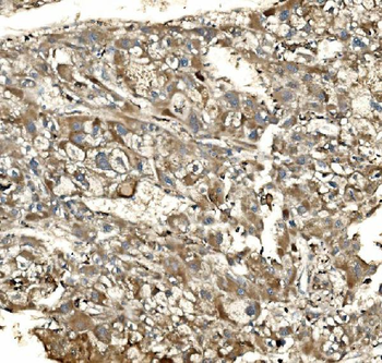 Anti-SV2A Antibody