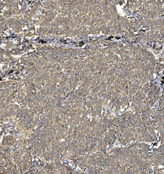 Anti-SV2A Antibody