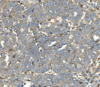 Anti-SV2A Antibody