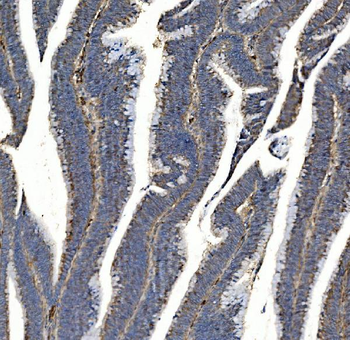 Anti-SV2A Antibody