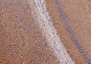 Anti-SV2A Antibody