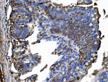 Anti-TRIM25/EFP Antibody