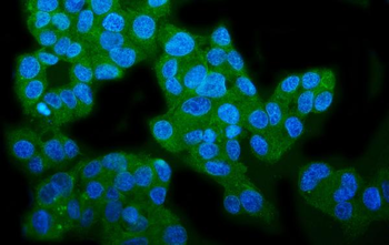 Anti-WFS1 Antibody