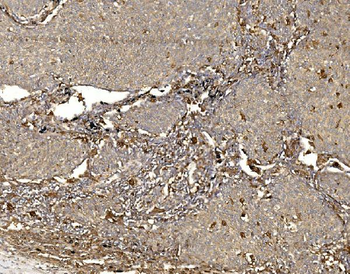 Anti-WFS1 Antibody
