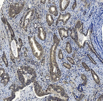Anti-SMAD2 Antibody (monoclonal, 3C4)