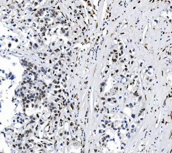 Anti-SAMHD1 Antibody (monoclonal, 3B9)