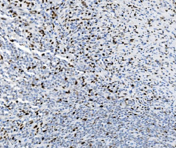 Anti-SAMHD1 Antibody (monoclonal, 3B9)
