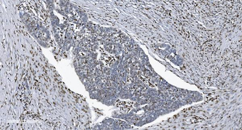 Anti-SAMHD1 Antibody (monoclonal, 10H8)