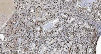 Anti-SAMHD1 Antibody (monoclonal, 10H8)
