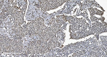 Anti-SAMHD1 Antibody (monoclonal, 10H8)