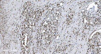Anti-SAMHD1 Antibody (monoclonal, 10H8)