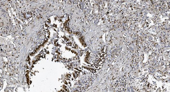 Anti-SAMHD1 Antibody (monoclonal, 10H8)
