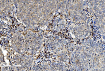 Anti-PNP Antibody (monoclonal, 7G5)