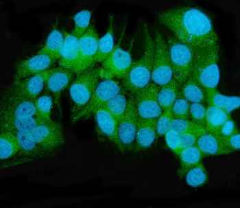 Anti-MEK2/MAP2K2 Antibody (monoclonal, 2B4)