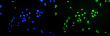 Anti-Ku70 Antibody (monoclonal, 9B6)