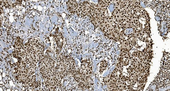 Anti-Ku70 Antibody (monoclonal, 9B6)
