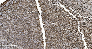 Anti-Ku70 Antibody (monoclonal, 9B6)