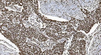 Anti-Ku70 Antibody (monoclonal, 9B6)