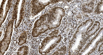 Anti-Ku70 Antibody (monoclonal, 9B6)