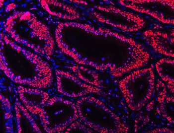Anti-Ku70 Antibody (monoclonal, 3D7)