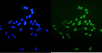 Anti-Ku70 Antibody (monoclonal, 3D7)
