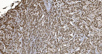 Anti-Ku70 Antibody (monoclonal, 3D7)