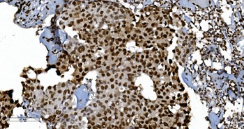 Anti-Ku70 Antibody (monoclonal, 3D7)