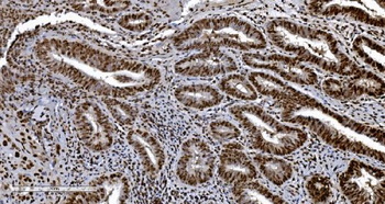 Anti-Ku70 Antibody (monoclonal, 3D7)
