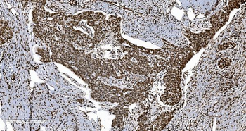Anti-Ku70 Antibody (monoclonal, 3D7)