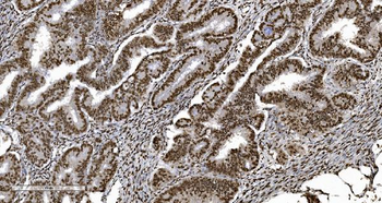 Anti-Ku70 Antibody (monoclonal, 3D7)