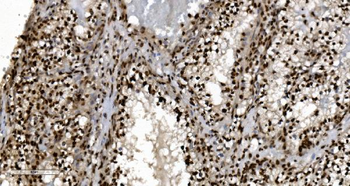 Anti-Ku70 Antibody (monoclonal, 3D7)