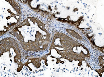 Anti-INPPL1 Antibody (monoclonal, 8C13)
