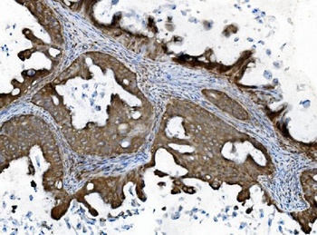 INPPL1 Antibody (monoclonal, 8C13)