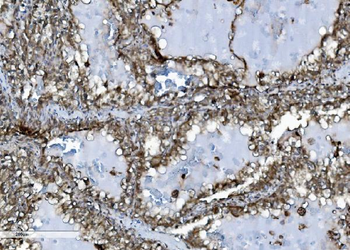 Anti-INPPL1 Antibody (monoclonal, 8C13)