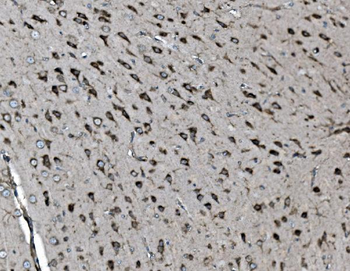 Anti-INPPL1 Antibody (monoclonal, 8C13)