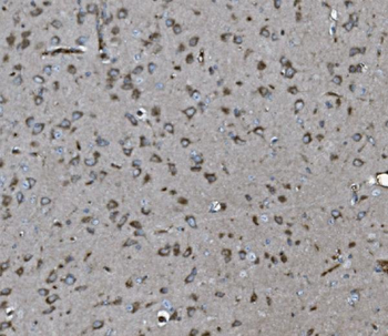 Anti-INPPL1 Antibody (monoclonal, 8C13)