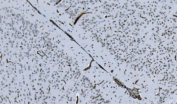 Anti-HP1 alpha/CBX5 Antibody (monoclonal, 8G6)